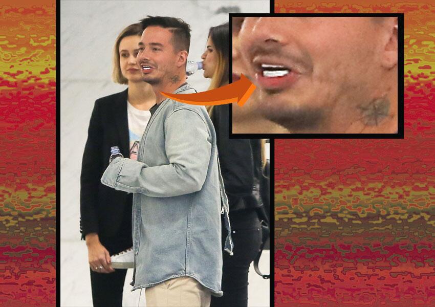 Balvin