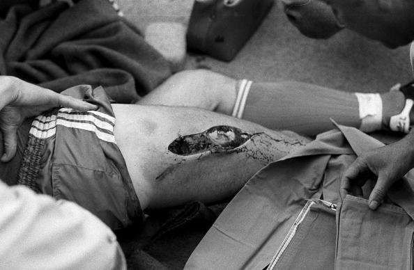 McCarthy sufrió fractura de tibia y peroné involuntaria de Rondón: “Espe...